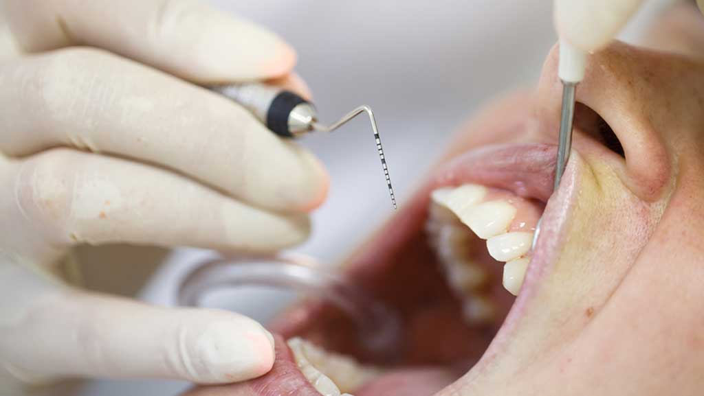 日本臨床歯周病学会認定歯科衛生士