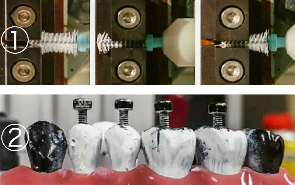 研究で使用された2種類の装置（① 人工的にスペースを設けた装置、② 上顎の犬歯から第3大臼歯までの模型）